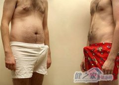 影响男人晨勃的6个原因