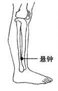 偏瘫的中医拔罐疗法