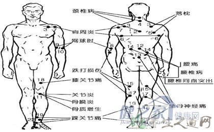 人体穴位图